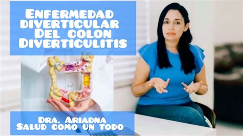 Enfermedad Diverticular Del Colon Diverticulitis Dra Ariadna Salud