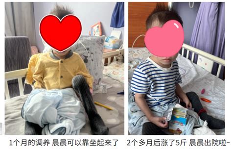 2岁男孩严重腹泻，9个月体重仅10斤！两个多月在“沙漠肠”中重建“绿洲”创奇迹 周到上海