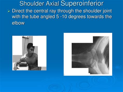 Ppt Shoulder Powerpoint Presentation Free Download Id604974