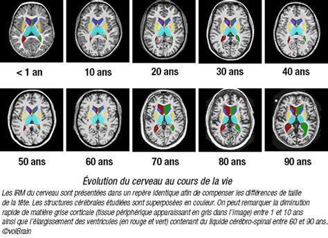 Comment Notre Cerveau Change T Il Au Cours De Notre Vie CNRS