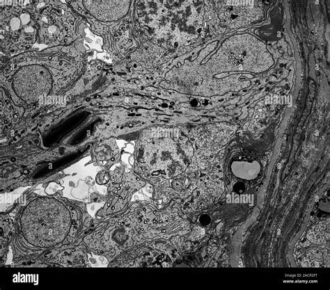 Sertoli Cell Transmission Electron Micrograph Tem Of A Section