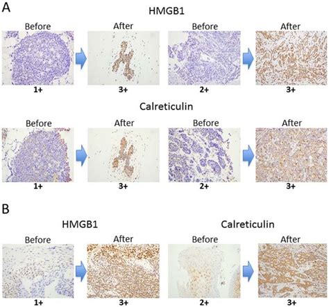 Representative Immunostainings Of Hmgb1 And Calreticulin Before And Download Scientific Diagram