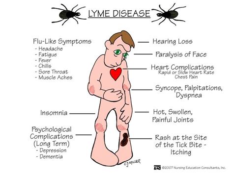 Lymedisease