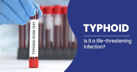 Typhoid Symptoms And Preventions