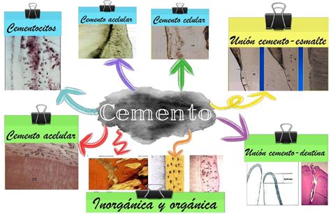 Res Menes De Cemento Acelular Descarga Apuntes De Cemento Acelular