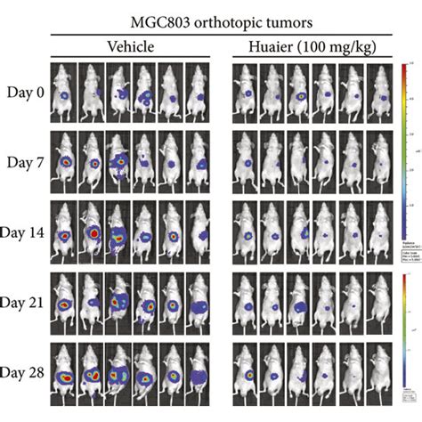 HBE Suppresses The Growth And Metastasis Of MGC803 Orthotopic Tumors