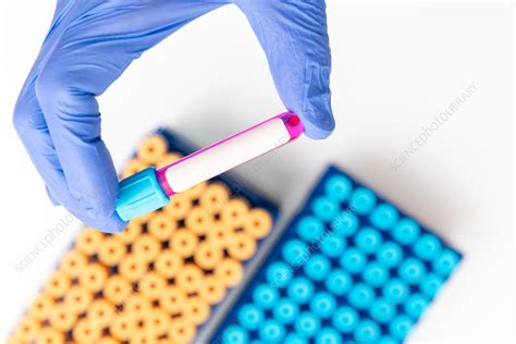 Medical Test Tube With Blood Sample Stock Image F Science