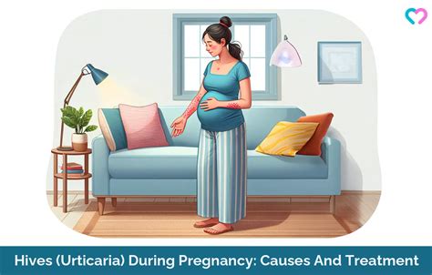 Hives Urticaria During Pregnancy Causes Treatment And Natural Remedies