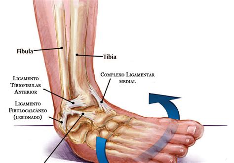 Fisioecia Entorse Tornozelo