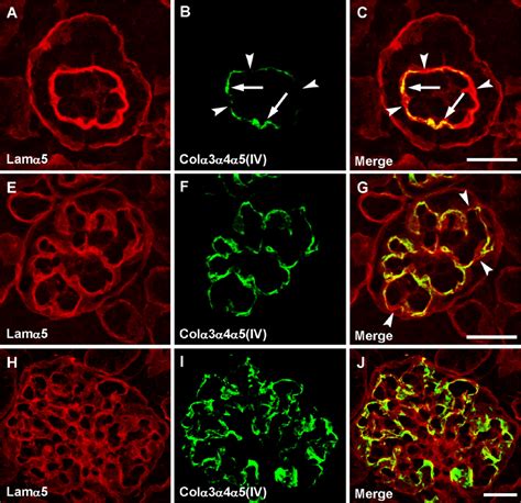 Laminin And Type IV Collagen Isoform Substitutions Occur In Temporally