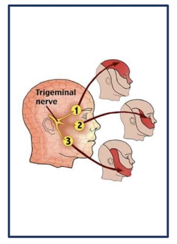 HA Trauma Neuro ClinMed Quiz 3 Flashcards Quizlet