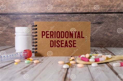 Prevention Of Dental Diseases Plastic Model Of The Tooth Next To The Nameplate Periodontal