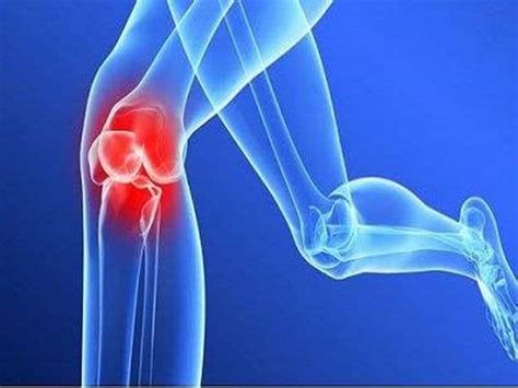 Acupuncture Therapy Knee Osteoarthritis