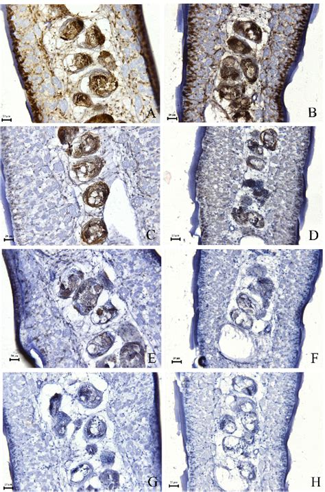 Pdf Immunohistochemical Localization Of Sex Hormone Receptors In Two