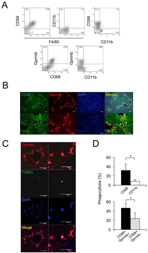 Characteristics Of Gpnmb Positive Cells Infiltrating Liver Tissue In