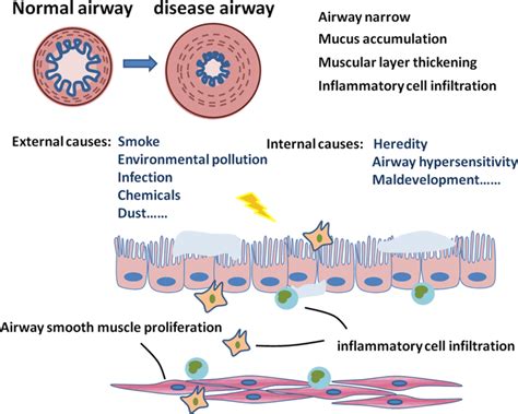 ASM Dysfunction Plays An Important Role In The Pathogenesis Of COPD