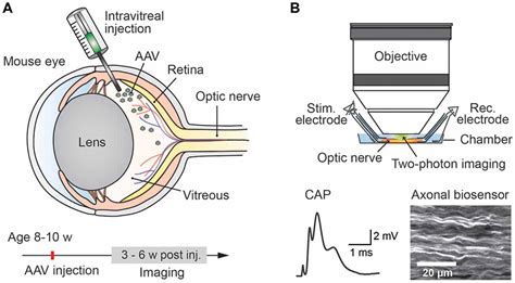 Intravitreal Injection