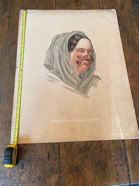 Antique Skin Disease Chromolithographs Rare Plates From The Etsy