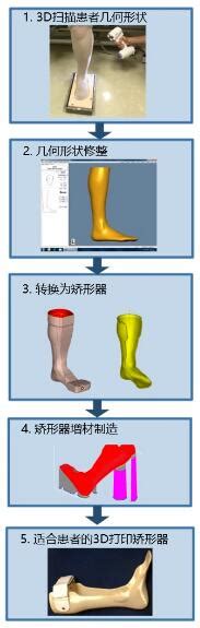 以足踝矫形器为例看3d打印康复辅具的应用、挑战及趋势 3d打印资讯 魔猴网