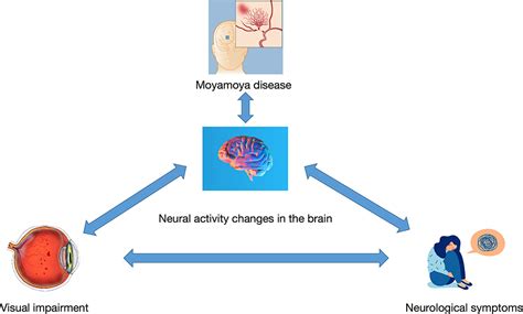 Frontiers Investigation Of Altered Spontaneous Brain Activities In