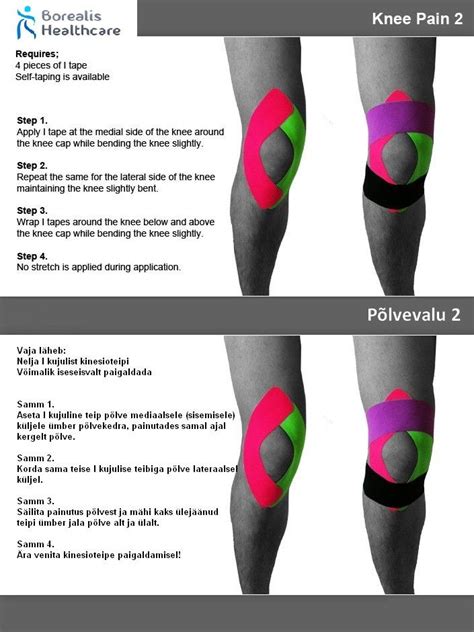 Kt Tape For Lateral Posterior Knee Pain At Allanrjohnsono Blog