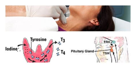 Tiroid Bezi Fonksiyon Testleri T4 T3 Tsh Kadınlar Kulübü Kadın Sitesi