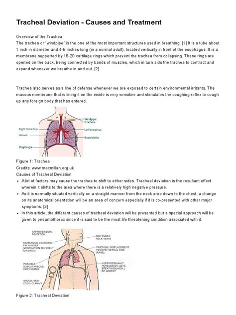 Tracheal Deviation - Causes and Treatment | Respiratory System ...