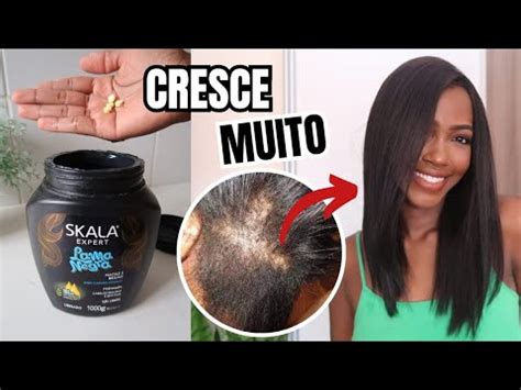 ESTE É O MELHOR REMÉDIO O CABELO CRESCE COMO LOUCO E NÃO CAI TODO