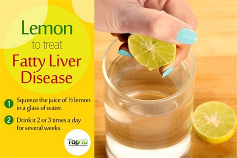 Home Remedies For Fatty Liver Disease Top 10 Home Remedies