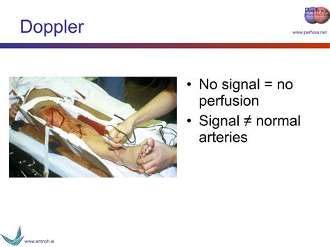 Vascular Trauma Ppt