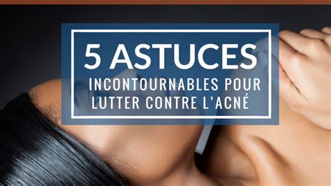 5 astuces incontournables pour lutter contre lacné Cabinet Hanederma