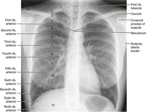 Normal Anatomy Radiology Key