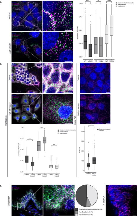 MolBoolean and in situ PLA staining of E cadherin and β catenin under