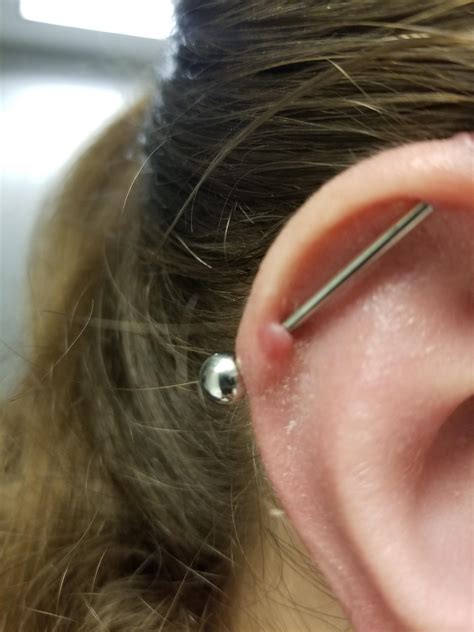 Industrial Piercing Keloid