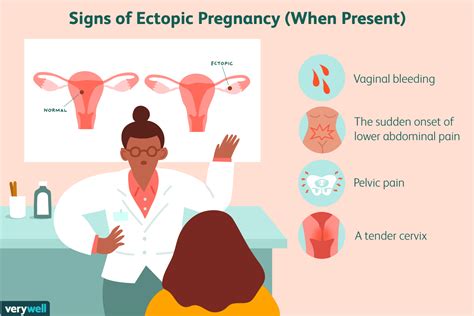 Ectopic Pregnancy Doral Health And Wellness — Womens Health Center