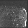 MRI Fast Spin Echo MR TIP Database