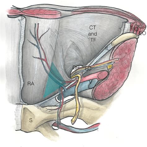 Figure From Imaging Of Inguinal Related Groin Pain In Athletes