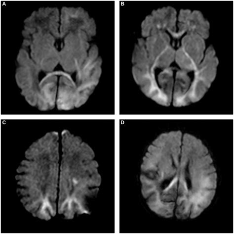 Frontiers The Advantages Of The Magnetic Resonance Image Compilation Magic Method For The