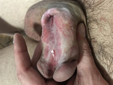 Fake Boobs Feel Fantastic 30 Nude Pics XHamster