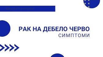 сигма дебело черво | 24 часа новини