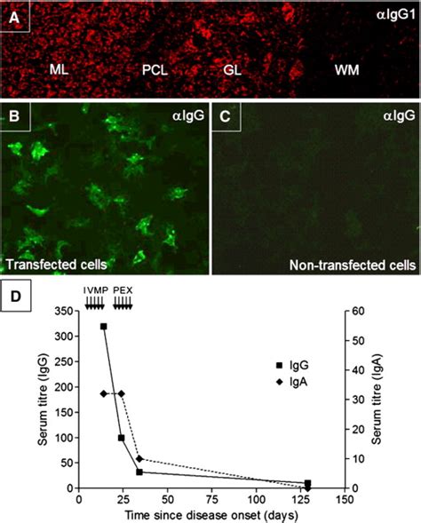 Gaba B Receptor Antibodies In Paraneoplastic Brainstem Encephalitis Journal Of Neuroimmunology