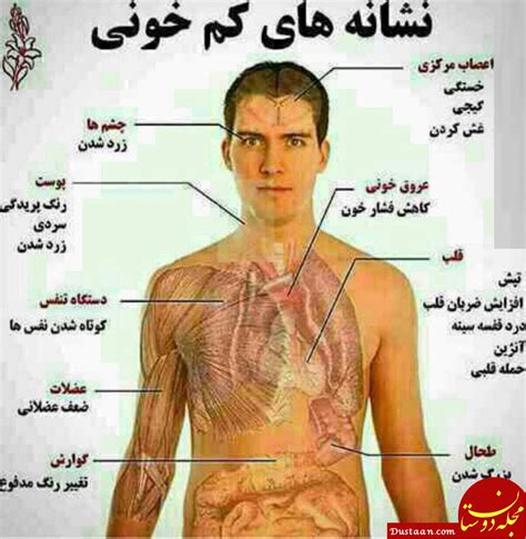 درمان کم خونی با کمک طب سنتی علایم کم خونی چیست؟ مجله اینترنتی دوستان