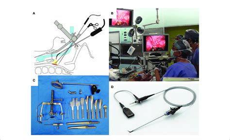 A Shema Of Transoral Videolaryngoscopic Surgery Tovs B Download Scientific Diagram