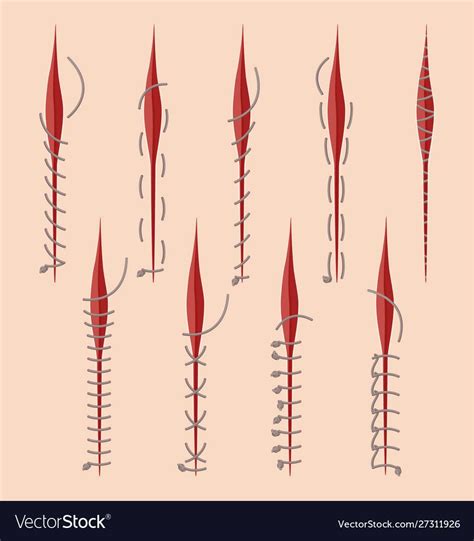 Series Of Different Medical Stitches Isolated Vector Image On
