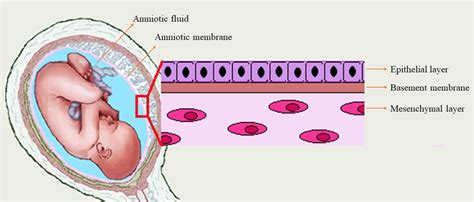 How Do Doctors Check For Amniotic Fluid Leak Sherilyn Ngo