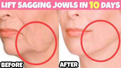 Anti Aging Face Lifting Massage For Sagging Jowls Cheeks Look