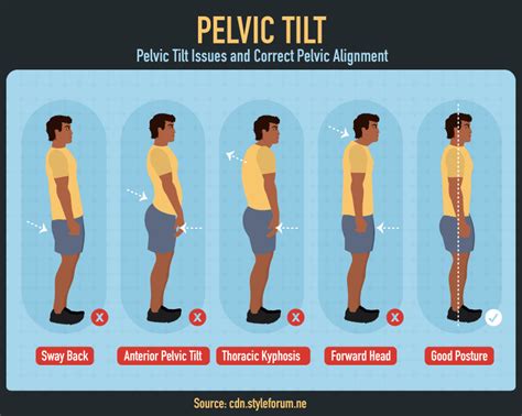 Improve Your Posture From Head To Toe Fix