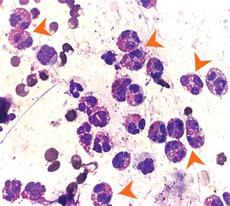 Eosinophilic Folliculitisfurunculosis In A Dog