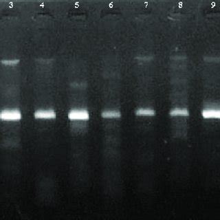 Ethidium Bromide Stained Agarose Gel Electrophoresis Of Sapovirus