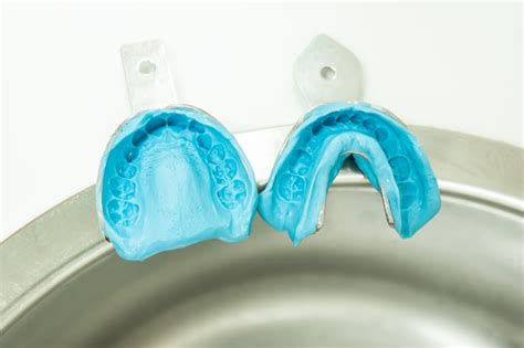 Dos Moldes De Alginato Azul Con Dos Muestras De Impresiones Dentales